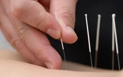Mecanismos de Ação da Acupuntura